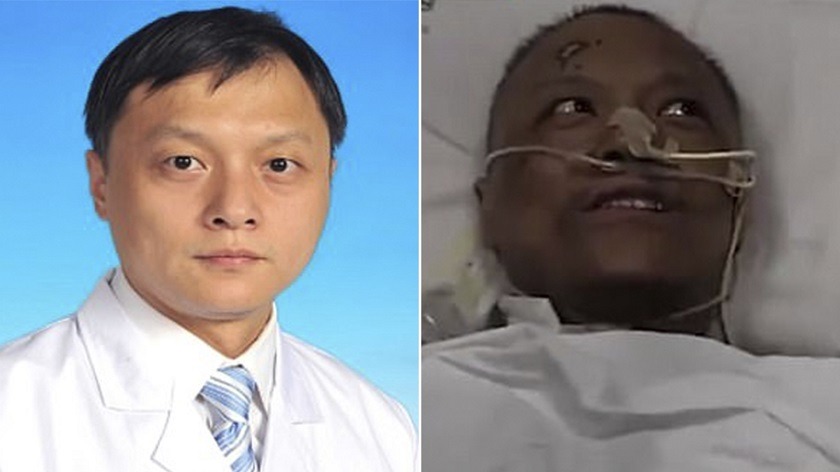 Médico chino al que le cambió el color de la piel por el coronavirus, falleció