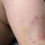 Joven madre de Neiva atacó a mordiscos a su bebé