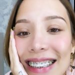 Así se ve Luisa Fernanda W con brackets