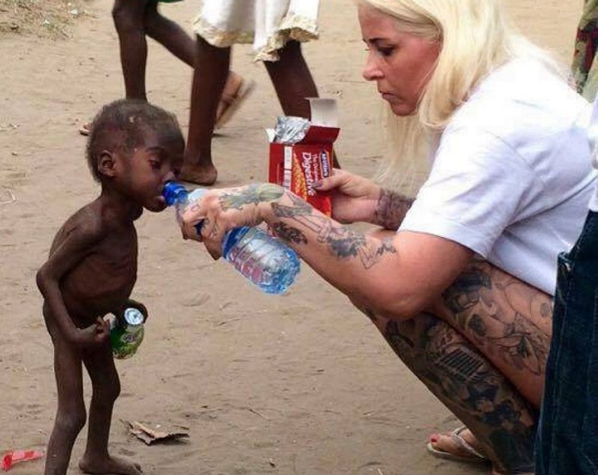 Hace 4 años este niño africano estaba así, y ahora