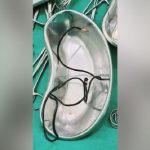 Insertó en su pene un cable de celular