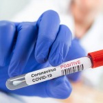 La COVID-19 no es una bacteria que se pueda combatir con antibióticos: Los tres tipos de pruebas que existen para detectar el coronavirus