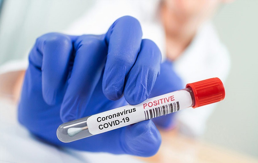 Los tres tipos de pruebas que existen para detectar el coronavirus