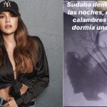 Las sábanas de Lina Tejeiro le revelaron uno de los síntomas de los biopolímeros