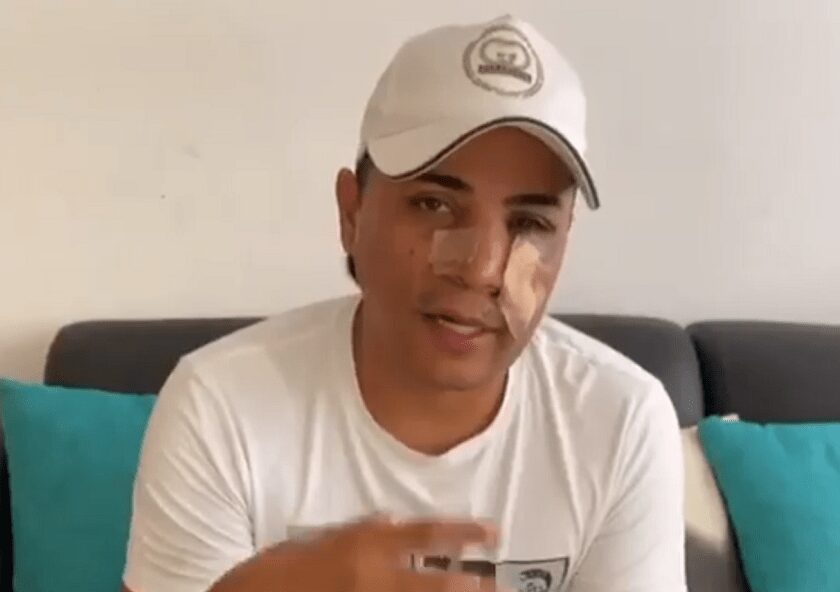 Mauricio Bastidas está recogiendo dinero para hacerse cirugía en el rostro tras recibir disparo