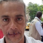 John Fitzgerald se cosió la boca y hace huelga de hambre en Bogotá