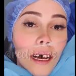 Manuela Gómez mostró videos del procedimiento quirúrgico que necesitó tras perder uno de sus dientes frontales.