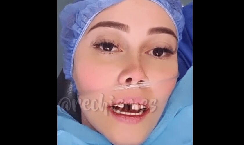 Manuela Gómez mostró videos del procedimiento quirúrgico que necesitó tras perder uno de sus dientes frontales.