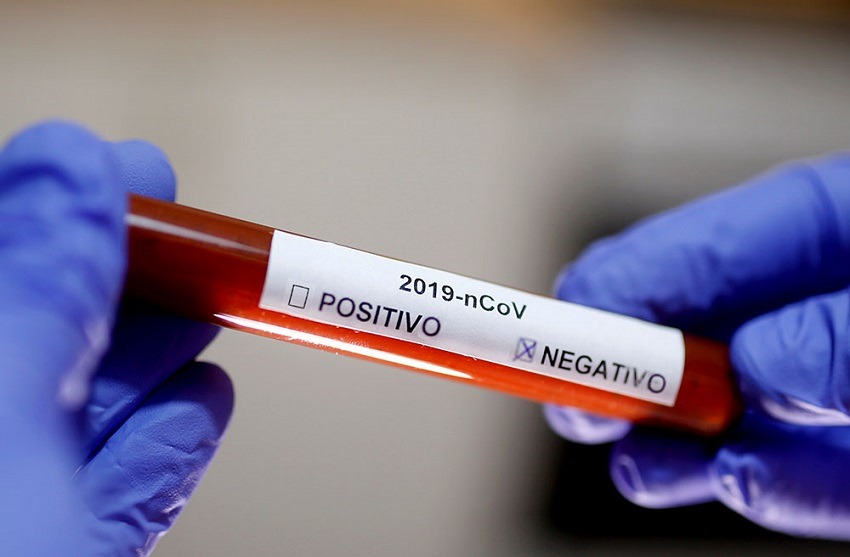 Sangre tipo O podría ofrecer cierta protección contra la infección por covid-19