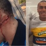 El impresionante accidente de Vladimir Marín por el que pide ayuda para una reconstrucción