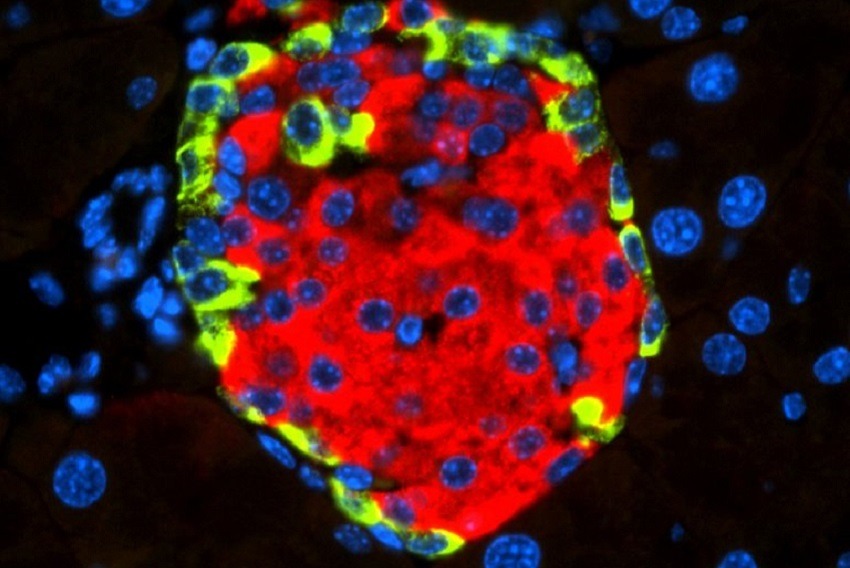 Identifican el mecanismo que explica cómo un virus puede causar diabetes