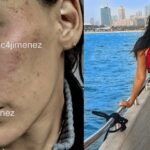 Así le quedó la cara a Stephanie Valenzuela tras la agresión de Eleazar Gómez