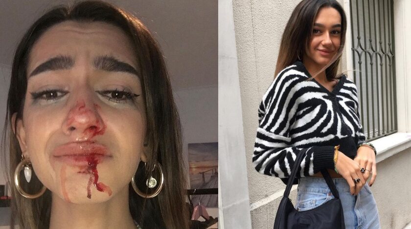 Eva Vildosola recibió una paliza solo por ser transexual: 'me han gritado "engendro"'