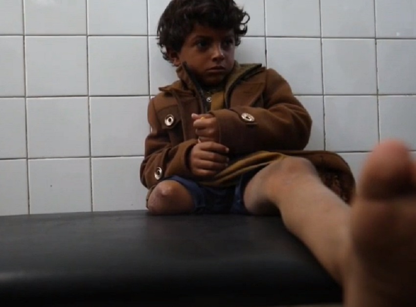 Huérfano y mutilado con 8 años, una de las vidas rotas por la guerra en Yemen