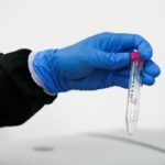 coronavirus - aguas residuales