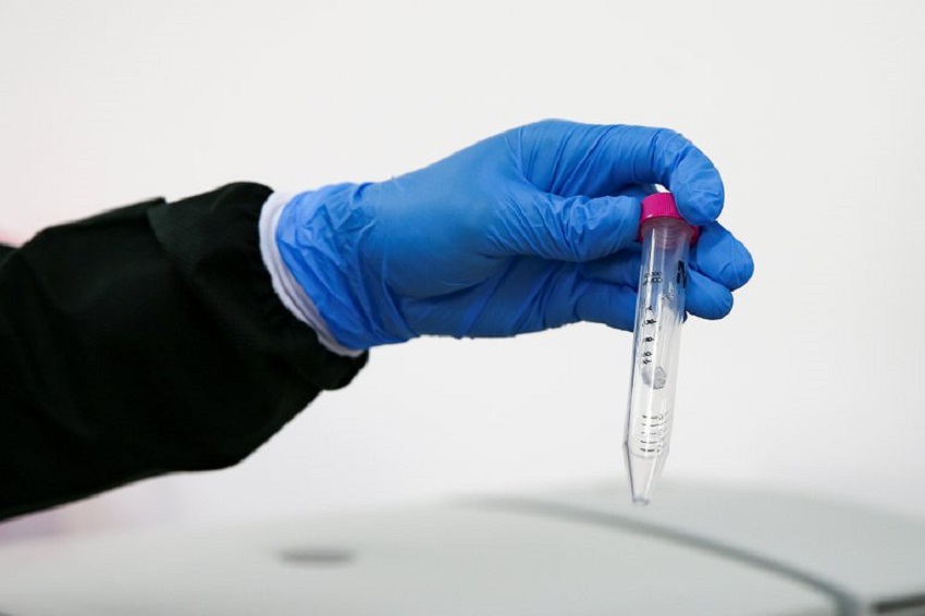 coronavirus - aguas residuales