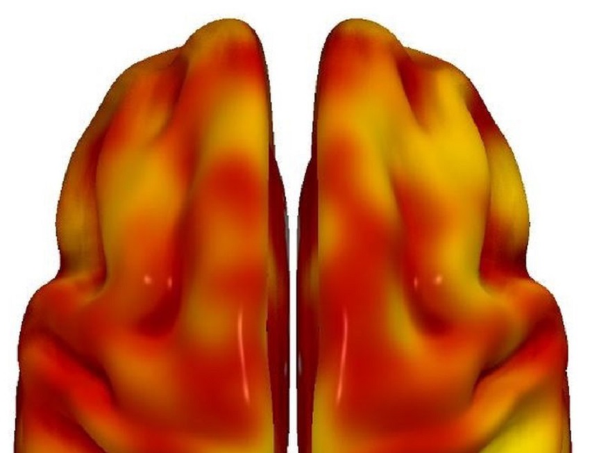 El riesgo cardiovascular y el declive cerebral se asocian en la mediana edad