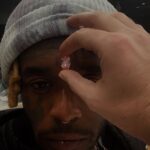 ¿Visión?, Lil Uzi Vert se implantó un diamante de 24 millones de dólares en su frente