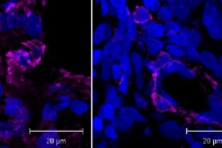 Probada en animales una terapia con nanopartículas para la fibrosis pulmonar