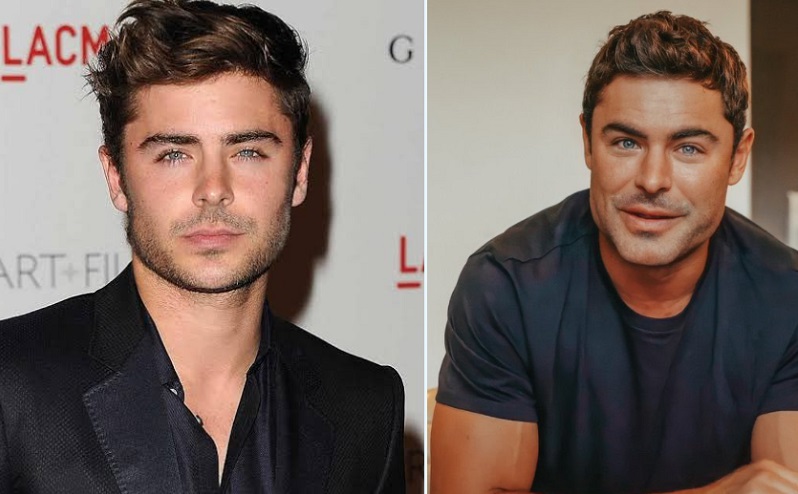 El nuevo rostro de Zac Efron está dañando el crush de toda una generación