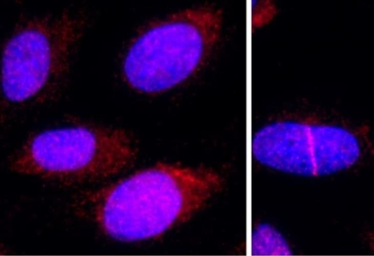Una proteína que ayuda a reparar el ADN podría potenciar la quimioterapia