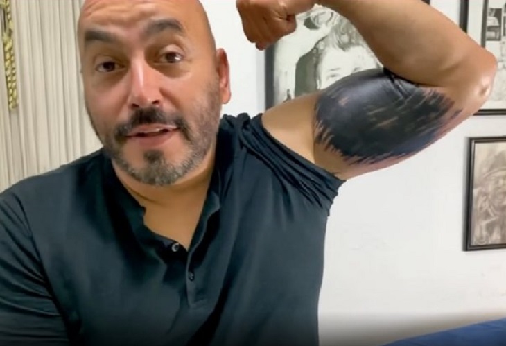 Lupillo Rivera se deshace del tatuaje de Belinda en su brazo