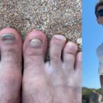 Las fotos de los pies de Thomas Müller que posteó en Instagram