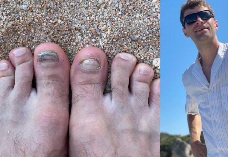Las fotos de los pies de Thomas Müller que posteó en Instagram