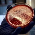 Cataluña notifica presencia de listeria en varios lotes de butifarra