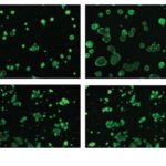 Corrigen mediante edición genética la fibrosis quística en organoides