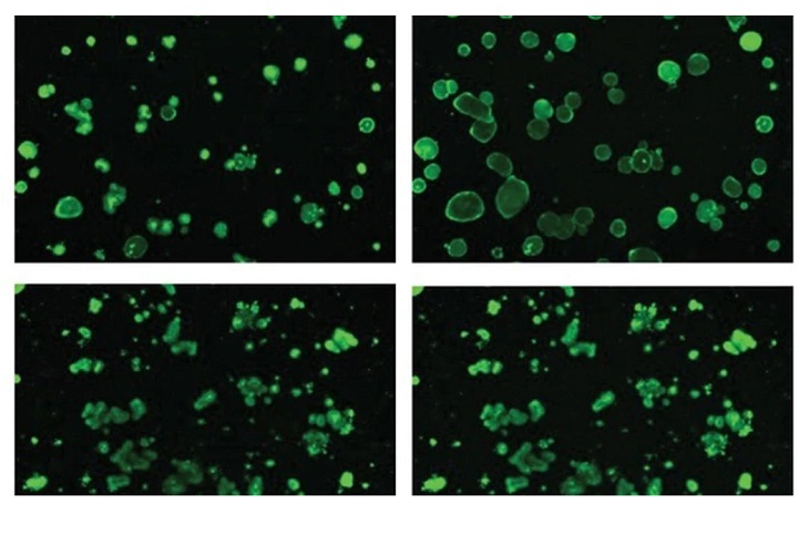 Corrigen mediante edición genética la fibrosis quística en organoides