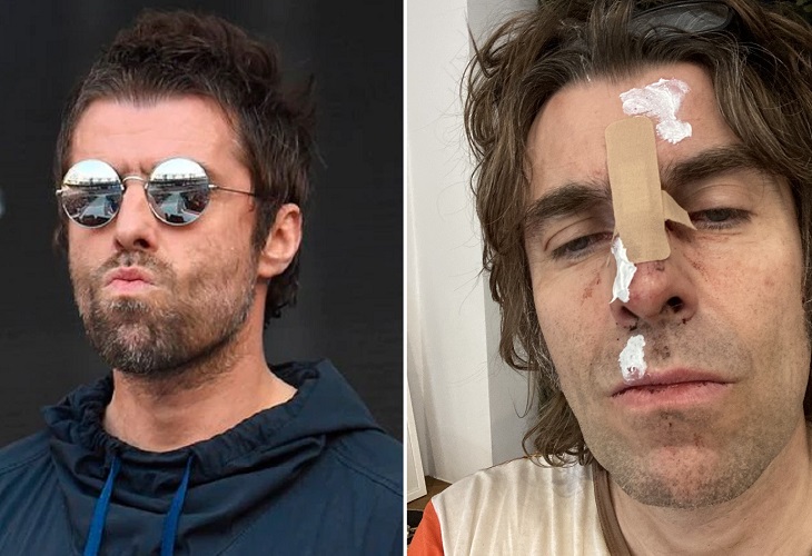 Liam Gallagher 2