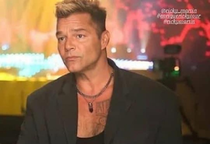 ¿Qué le pasó en el rostro a Ricky Martin?, sufría una reacción alérgica
