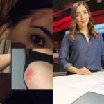 Gabriela Cárdenas: periodista de City TV golpeada en taxi
