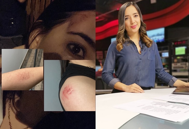 Gabriela Cárdenas: periodista de City TV golpeada en taxi