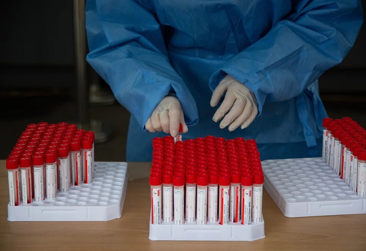 EEUU ha detectado hasta ahora 43 casos de ómicron, la mayoría leves