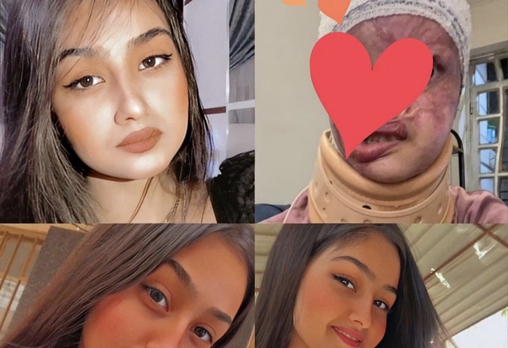 Ataque con ácido a Mariam Rikabi por parte de hombre en Irak