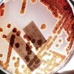 1,2 millones murieron en 2019 por infecciones resistentes a los antibióticos