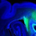 Descubren un tipo de gen que regula el tamaño del cerebro en las especies