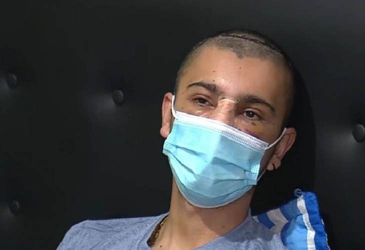 A Óscar Daniel Porto le rompieron la cabeza y cara en robo en Transmilenio