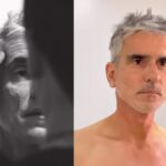 Video de Miguel Varoni tras el rejuvenecimiento facial