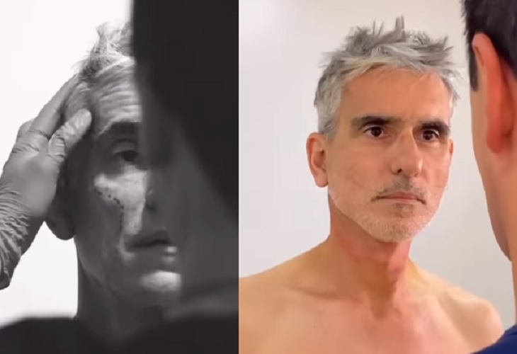 Video de Miguel Varoni tras el rejuvenecimiento facial