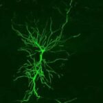Crean una sonda que emplea la luz para diagnosticar patologías cerebrales