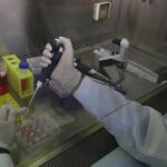 Un análisis de heces podría ayudar a detección temprana de cáncer de páncreas