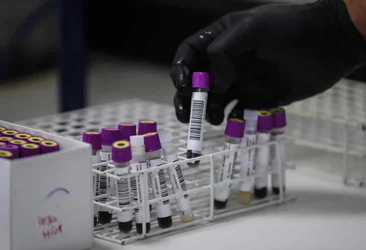 Un bajo reservorio de VIH en células de vida corta facilitaría la curación