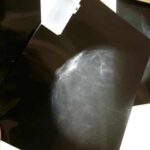 Un caballo de Troya farmacológico se reafirma como terapia contra el cáncer