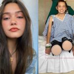 Carolyn Claire Bridges, la modelo que perdió sus dos piernas tras el COVID