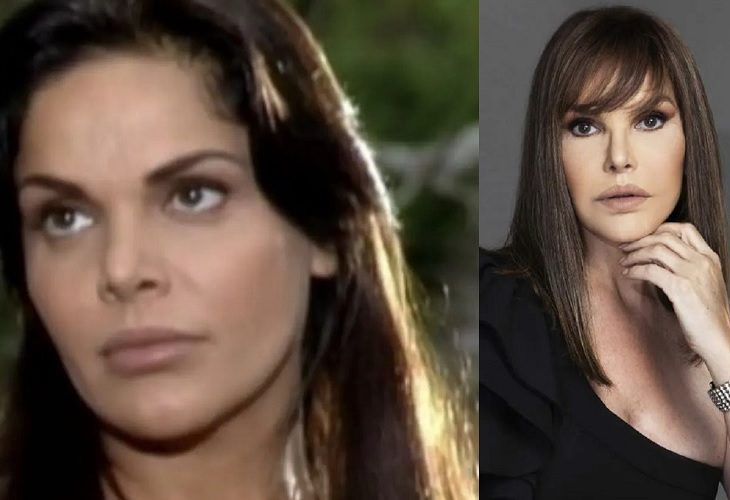 Hilda Abrahamz: qué le pasó en la cara a actriz de mi gorda bella