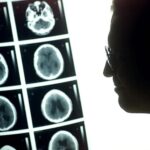 Imágenes sintéticas mejoran el diagnóstico y tratamiento del tumor cerebral