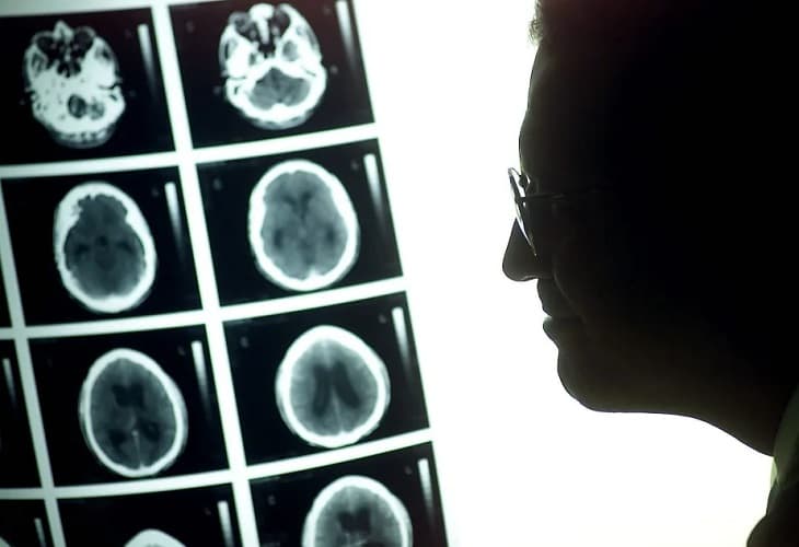 Imágenes sintéticas mejoran el diagnóstico y tratamiento del tumor cerebral